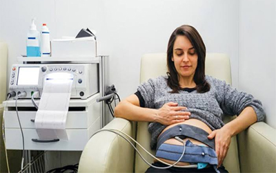 CARDIOTOCOGRAPHY IMAGE